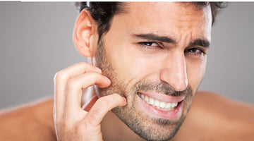 How to stop your beard from itching